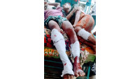 নাচোলে জমিজমার বিরোধে নিজ আত্মীয়ের দ্বন্দে পিতা-পুত্র  আহত